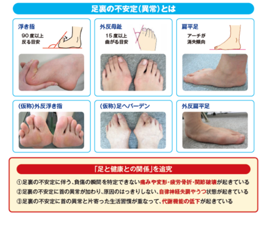 外反母趾の痛みを軽減するには - 葛飾区・亀有駅から徒歩90秒で巻き爪